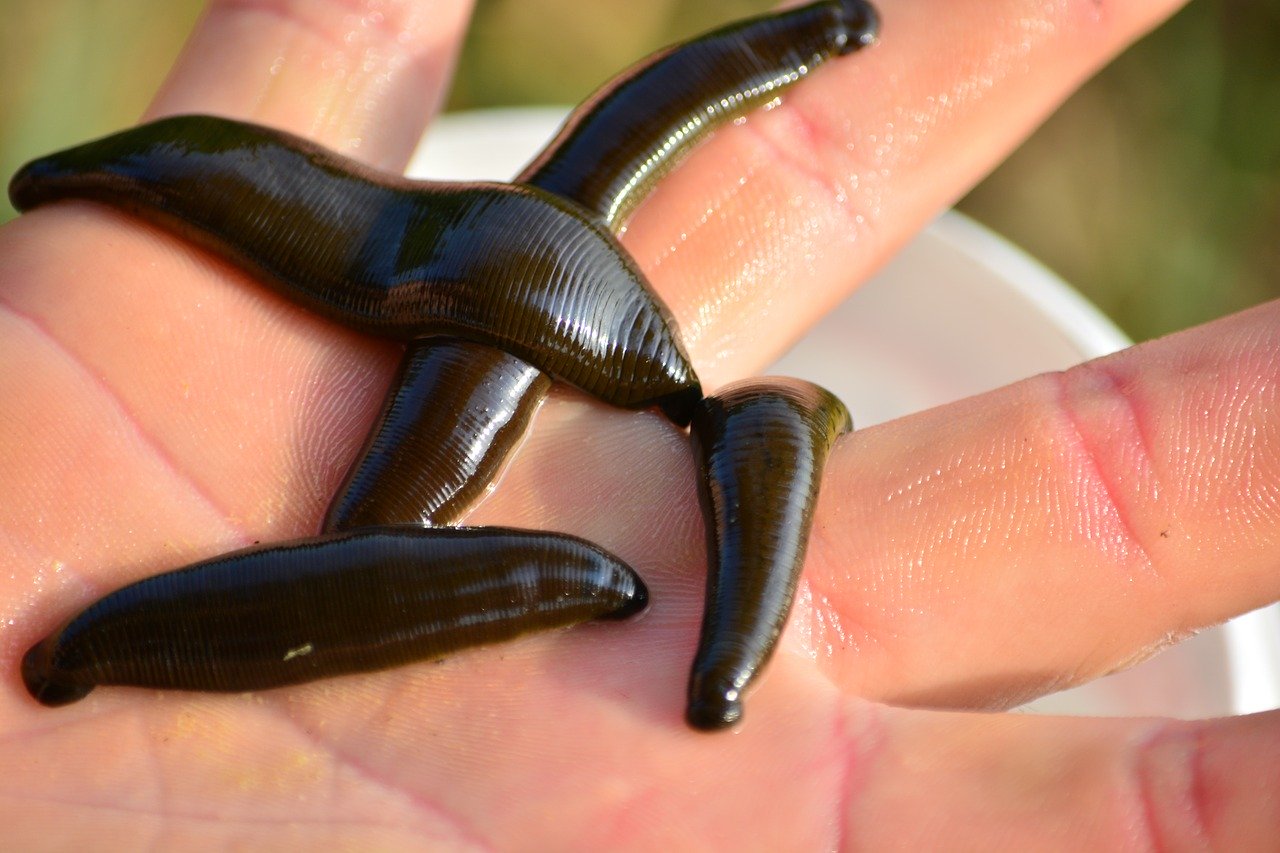 Dream about leeches on my hands